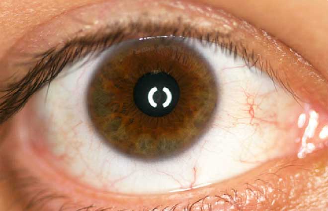 Patented Digital Prosthetic Eye Technology