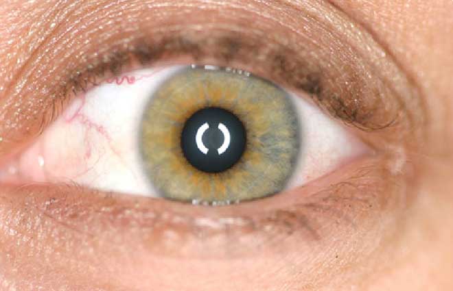 Patented Digital Technology for Prosthetic Eyes