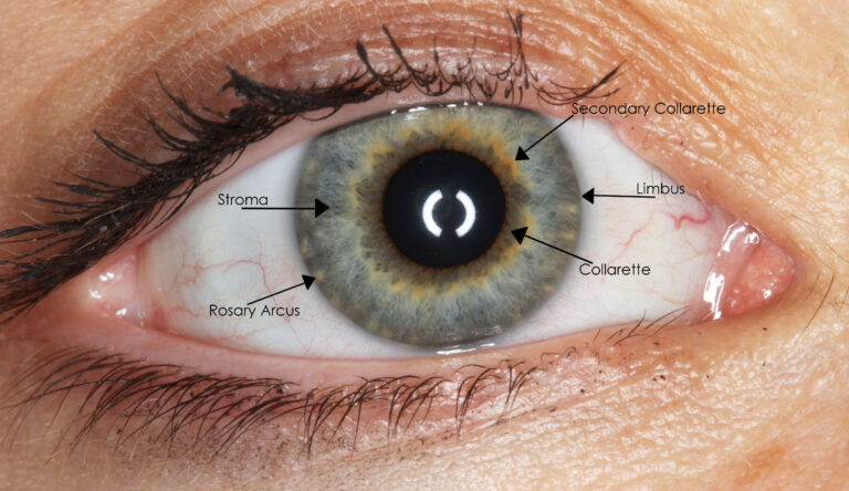Prosthetic Eye Details | Esthetic Eyes